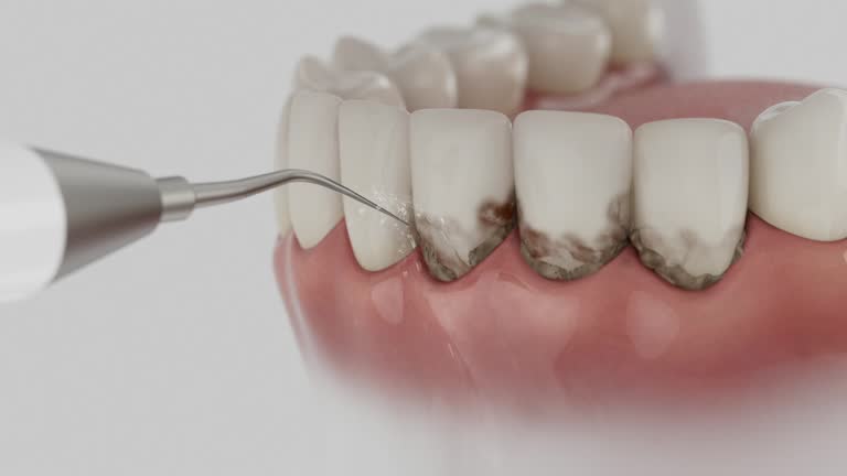 Trusted Wisdom Tooth Removal service in Kurtistown, HI - Dentist Open Now